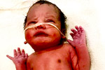 test tube babies process in Hyderabad