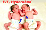 Best fertility centre in hyderabad