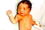 surrogacy results 
    Hyderabad