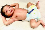 Best fertility centre in hyderabad