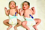 Best fertility centre in hyderabad