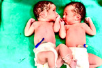 test Tube Baby Centres Hyderabad