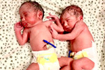 best surrogacy centre in Hyderabad