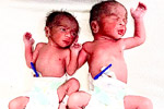 fertility hospital 
            bangalore