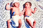 infertility centres in 
        chennai
