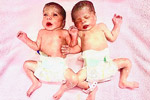 infertility centres in chennai