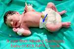 test tube babies process in Hyderabad