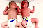 ivf success rate in Hyderabad