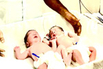 Best fertility centre in hyderabad