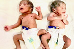 Best fertility centre in hyderabad