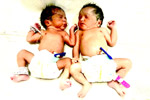 Best fertility centre in hyderabad