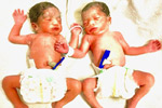 Best fertility centre in hyderabad
