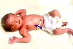 Best fertility centre in hyderabad