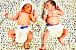 Best fertility centre in hyderabad