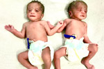 Best fertility centre in hyderabad