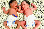 Best fertility centre in hyderabad