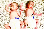 ivf hyderabad