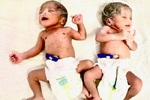 Best fertility centre in hyderabad