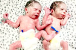 surrogacy cost in 
        Hyderabad