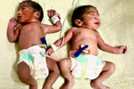 Best fertility centre in hyderabad