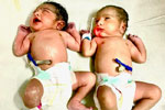 Best fertility centre in hyderabad