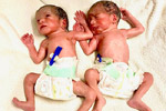 test Tube Baby Centres Hyderabad