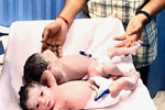 Best fertility centre in hyderabad