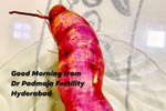 Best fertility centre in hyderabad