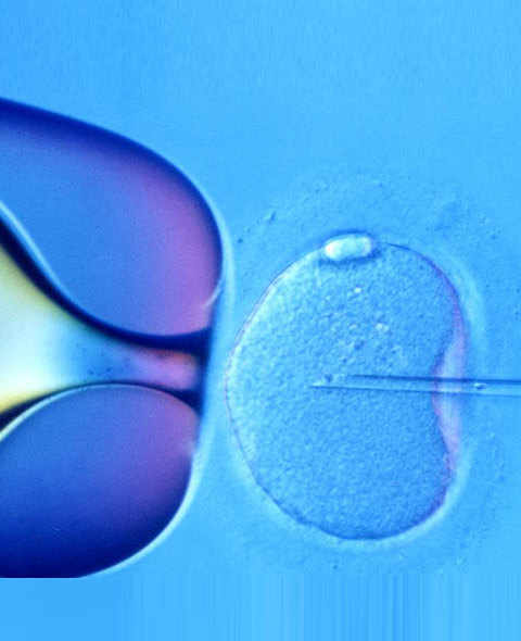 best ivf centre in Hyderabad